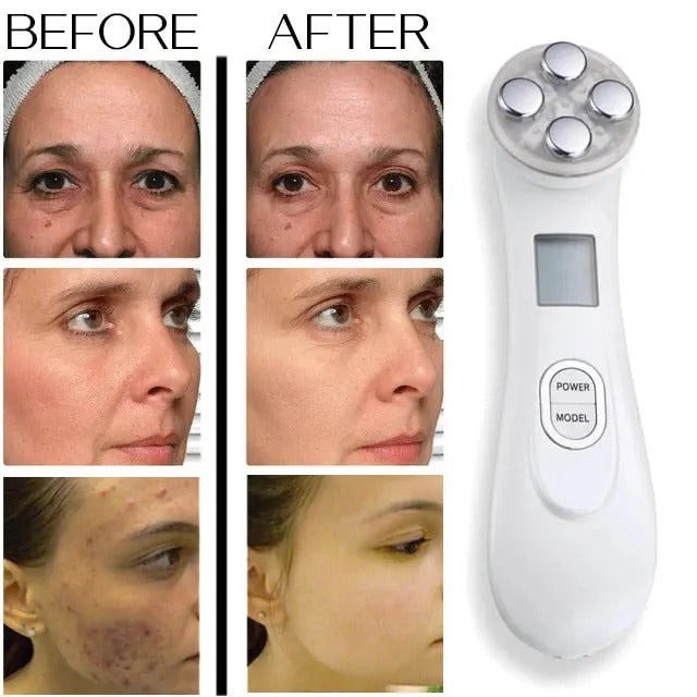 Genève™ | Skin Rejuvenation Device