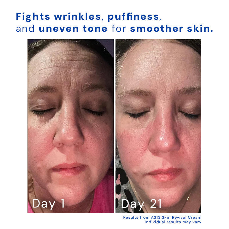 Retinol Face Cream