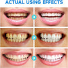 PureTeeth™ | Niacinamide Whitening Toothpaste