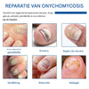 Nailox™ – Effective Nail Fungus Treatment