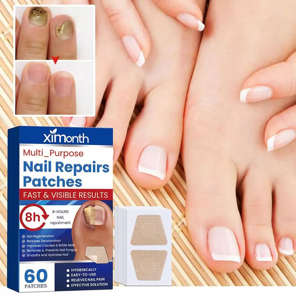 Nailox™ – Effective Nail Fungus Treatment