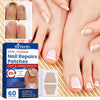 Nailox™ – Effective Nail Fungus Treatment