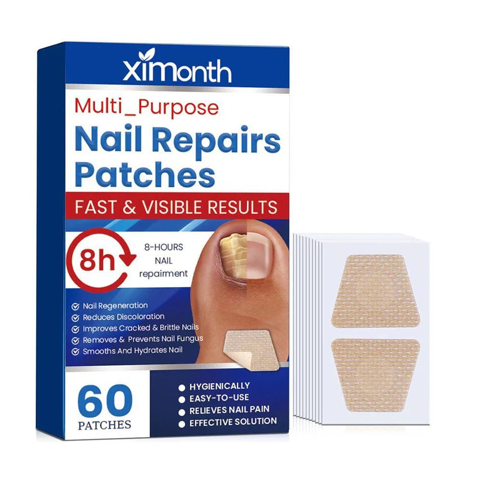 Nailox™ – Effective Nail Fungus Treatment