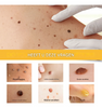 BeeNaturale™ – Gently Removes Skin Tags and Blemishes