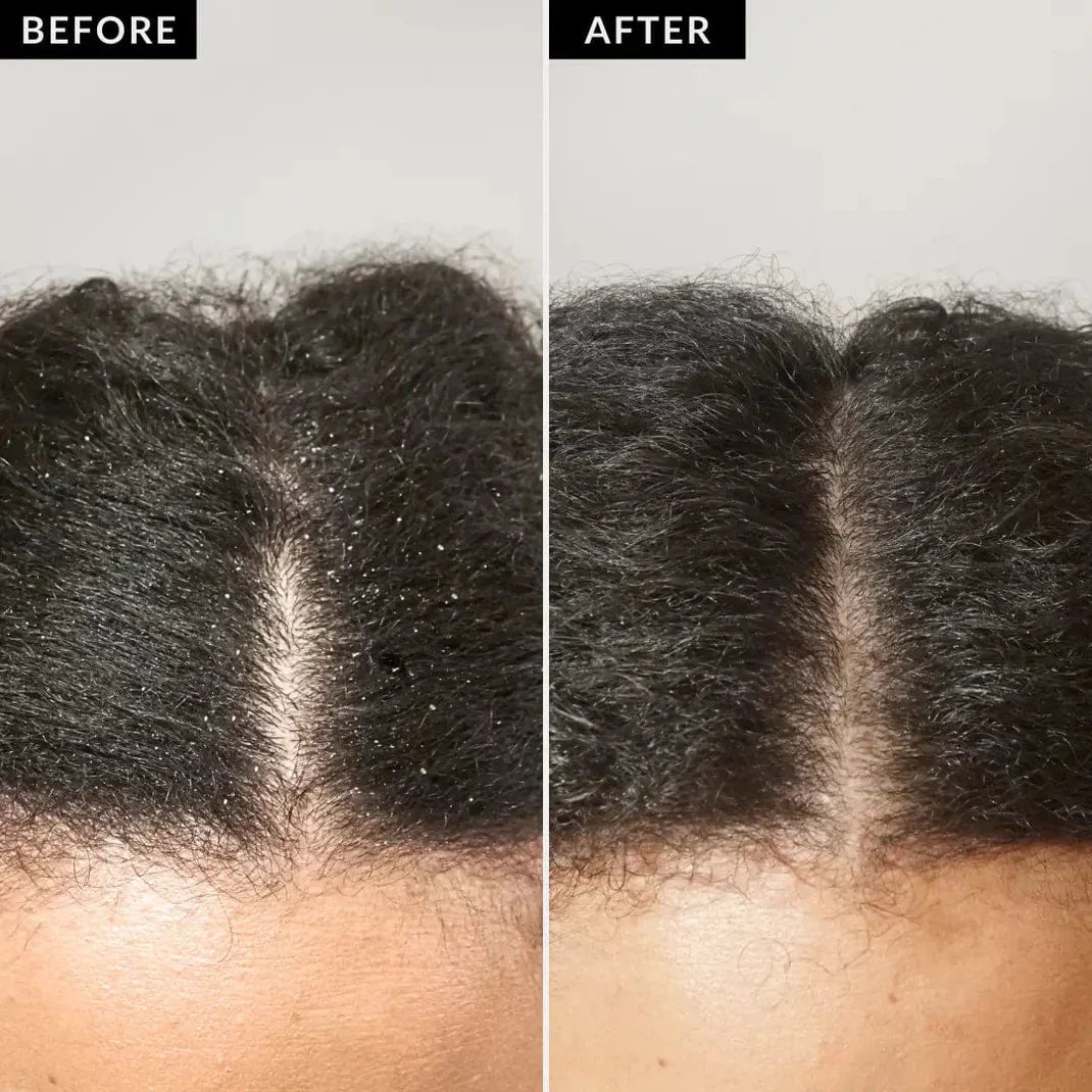 Clyvea™ Scalp Detox Comb